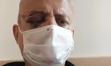 Metrobüste gör eden maske uyarısı! Güvenlik görevlisi tek gözünü kaybetti