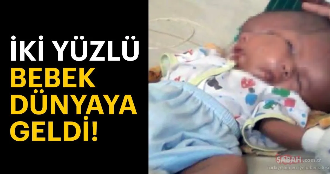 Endonezya�da iki yüzlü bebek dünyaya geldi! Son Dakika Endonezya�da iki yüzlü bebek dünyaya geldi! Son Dakika