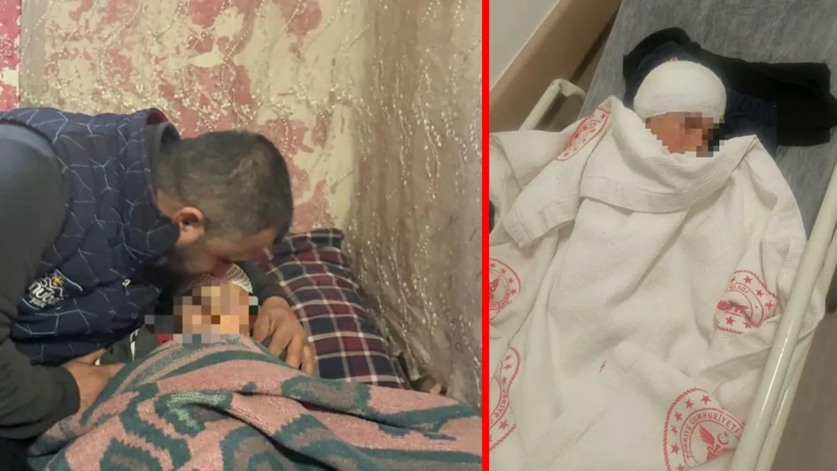 Kayseri’de köpek saldırısı dehşetinde kan donduran skandal! Acılı babaya akılalmaz para teklifi! Kayseri’de köpek saldırısı dehşetinde kan donduran skandal! Acılı babaya akılalmaz para teklifi!