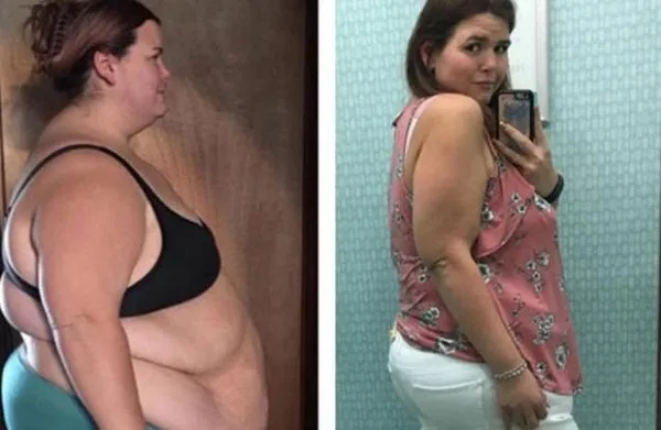 100 kilo verdi şimdi görenler güzelliğine hayran kalıyor!