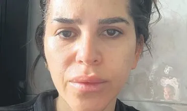 SON DAKİKA | Gençlik aşısı yaptırdı kabusu yaşadı! Yüz felci geçirdi, mimiklerini kaybetti: