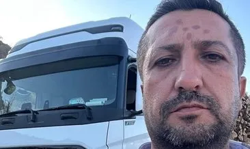 Şanlıurfa’da aracın damperin elektrik tellerine temas eden sürücü öldü #sanliurfa
