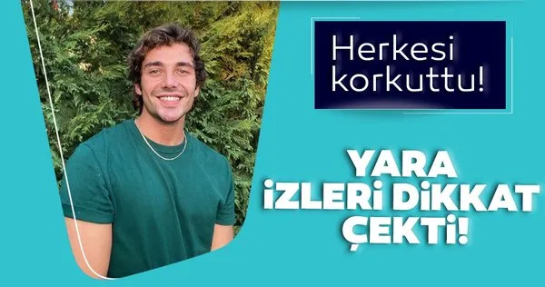 Cemal Can Canseven'in yara izleri dikkat çekti!