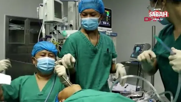 Çin'de 5 yaşındaki çocuğun boğazından canlı solucan çıkarıldı | Video