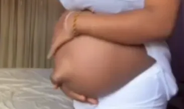 Hamile kadının göbek deliğini görenler şaşkına döndü! Bu görüntü sosyal medyayı salladı: Uzmanlardan açıklama geldi