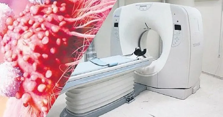 Röntgen ile kanser arasında bağ var