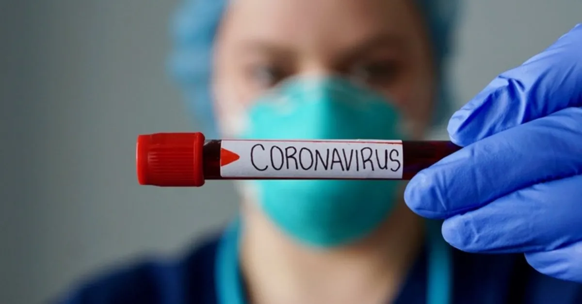 korona test sonucu ne zaman cikar nereden ogrenilir e nabiz ile corona test sonucu kac gunde cikar belli olur son dakika haberler
