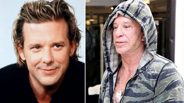 Ünlü aktör Mickey Rourke estetik operasyonların kurbanı oldu