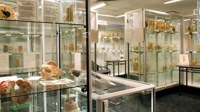 Dünyanın en korkutucu tıp müzeleri
