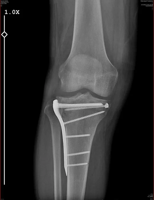 Son dakika: Maseratili polis olayında yeni detaylar: 'Bakanlık onaylı çay' iddiası yalan çıktı