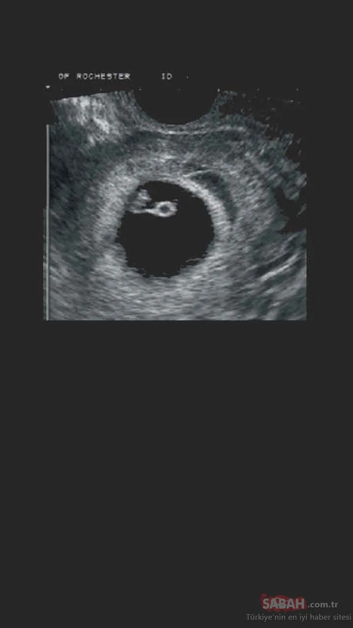 hafta hafta ultrason goruntuleri galeri bebegim ve biz