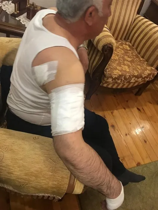 Arpaçay Belediye Başkanı, köpek saldırısında yaralandı