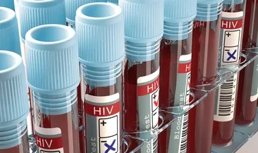 Virüsler farklı ders ortak