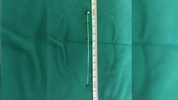 30 yıl boyunca baÅ aÄrısı çekti! Nedeni ise...