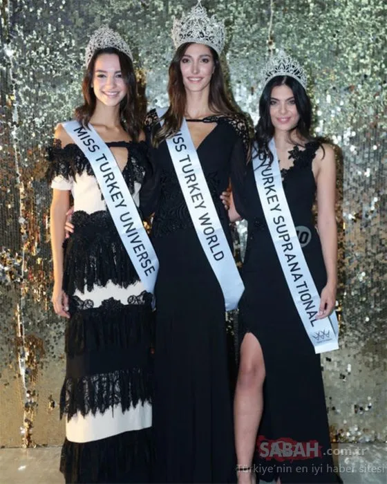 Miss Turkey ödülü doktorun hakkı! Şevval Şahin�in estetiksiz hali olay