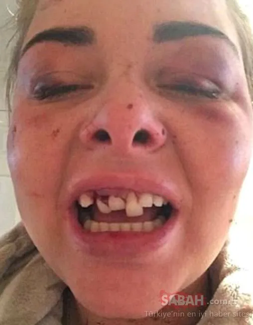 Sosyal medyadan fotoğrafları silmek genç kadının felaketi oldu!