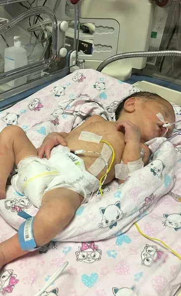 Trafik kazasında ölen annenin karnındaki bebek böyle kurtarıldı! Mucize gibi yaşam savaşı...