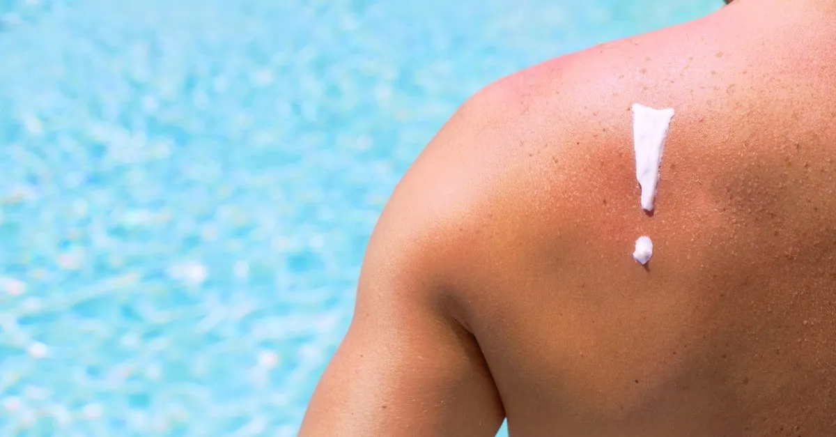 bu uyari sasirtti gunes yanigina