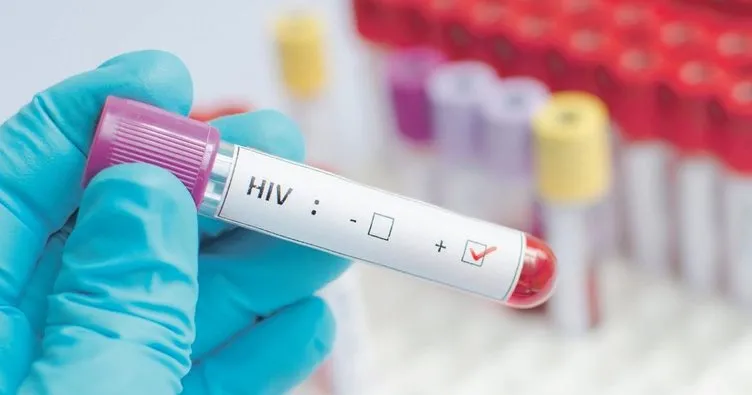 HIV virüsü taşıdığını eşinden gizledi