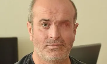 ‘Hayatımı mahveden saldırganı yakalayın’