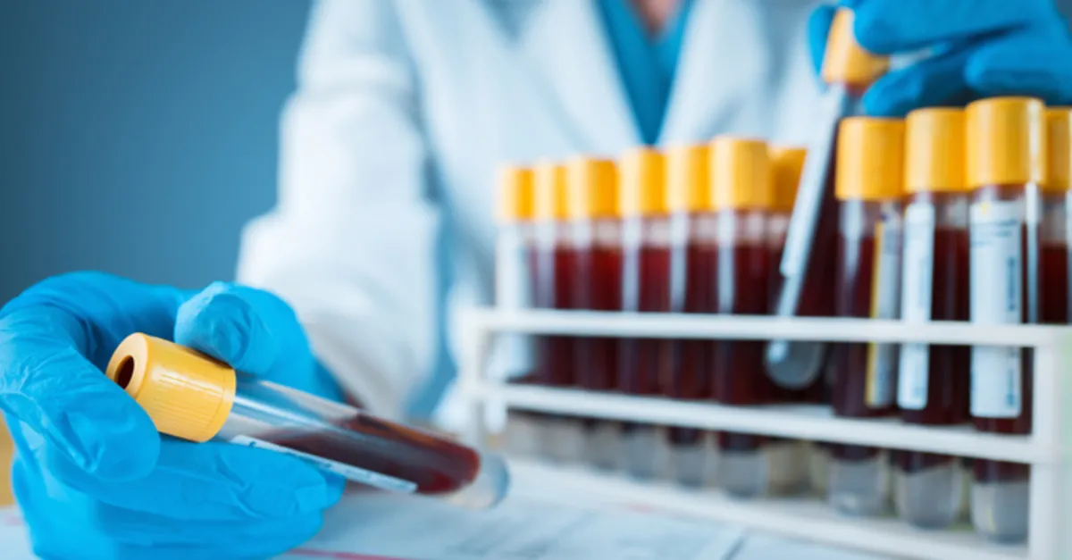 t c kimlik no ile tahlil sonucu ogrenme e nabiz mhrs ile tahlil ve patoloji sonucu ogrenme islemi 2021 saglik haberleri t c kimlik no ile tahlil sonucu ogrenme e nabiz mhrs ile tahlil ve patoloji sonucu ogrenme islemi 2021 saglik haberleri