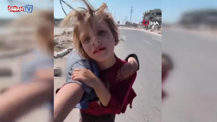 Gazze’de küçük kız çocuğu yaralı kardeşini kilometrelerce omzunda taşıdı | Video