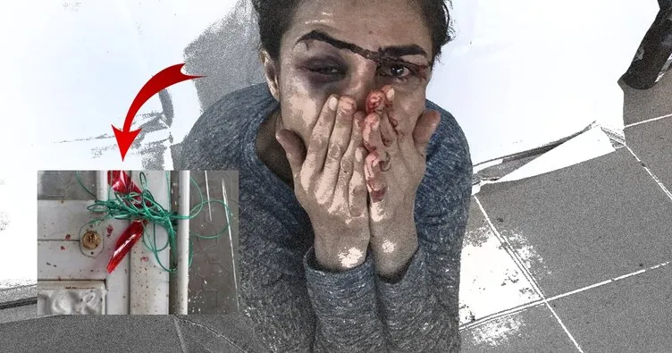 Son dakika | Bağlanarak tecavüze uğrayan Melek İpek için flaş gelişme