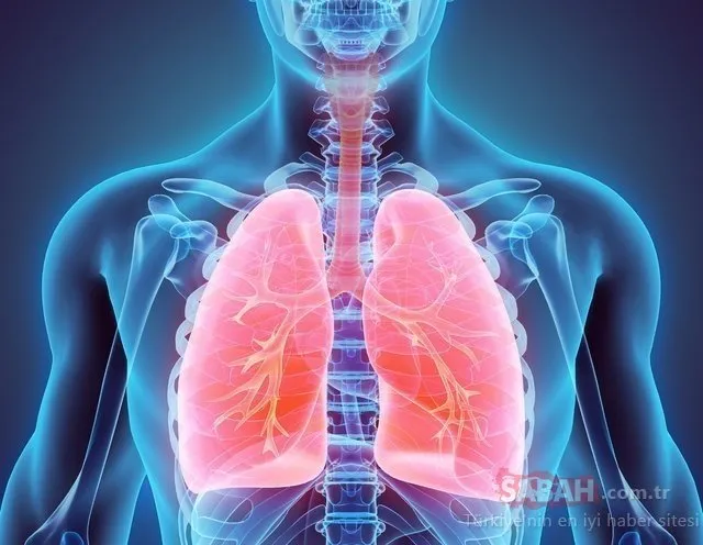 Akciğer Kanseri belirtileri nelerdir? Akciğer Kanseri neden olur, nasıl teşhis konulur, belirtisi nedir?