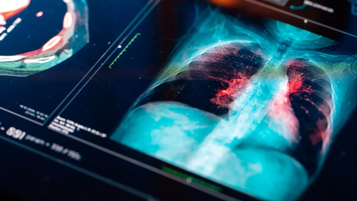 Akciğerleri yerle bir eden sessiz tehlike! Uzmanlar uyardı: “İnsanların %80’i hastalığını bilmiyor…”