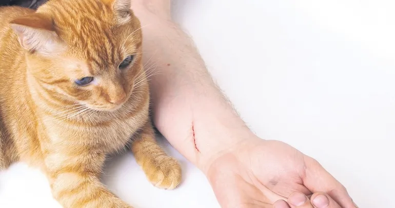 ‘Kedi tırmığı’ deyip geçmeyin!