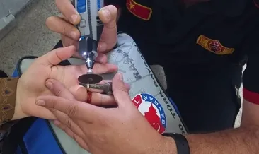 İtfaiyeden yüzük operasyonu