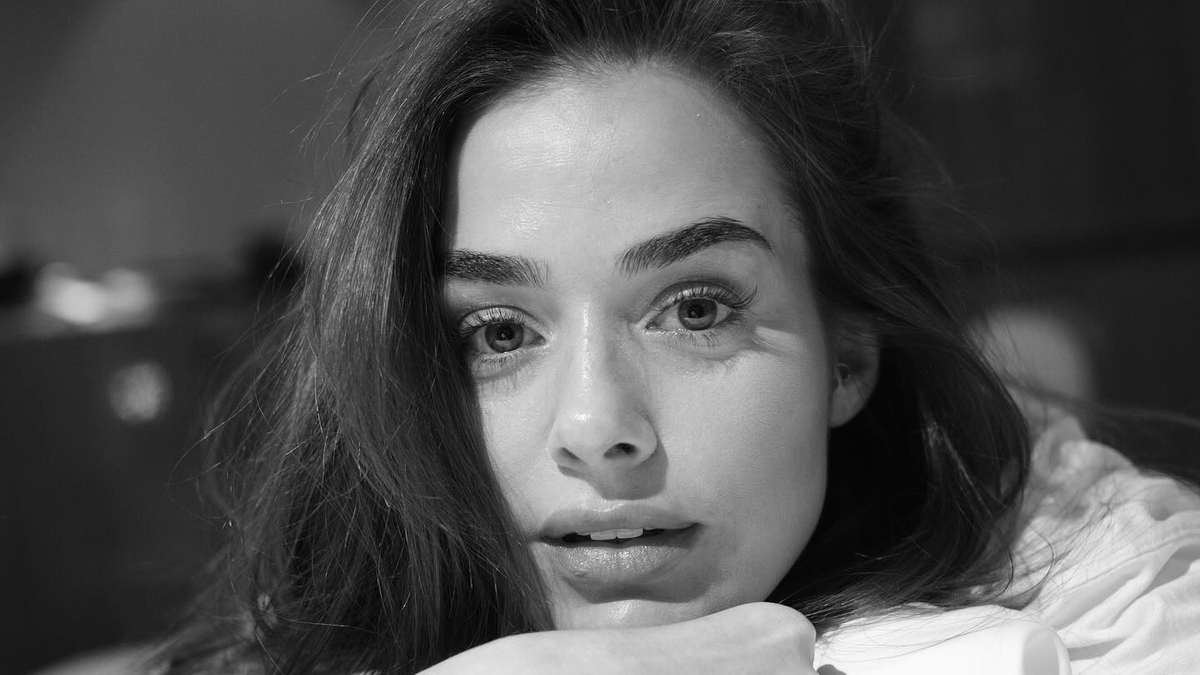 Bensu Soral’ın yüzünün son hali görenleri şaşkına çevirdi!