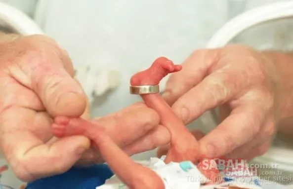 Yenidoğan yoğun bakımlara sil baştan düzenleme: Sağlık Bakanlığından özel çalışma: İşte detaylar!