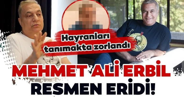 Ünlü şovmen Mehmet Ali Erbil resmen eridi! Mehmet Ali Erbil’i görenler tanıyamadı!