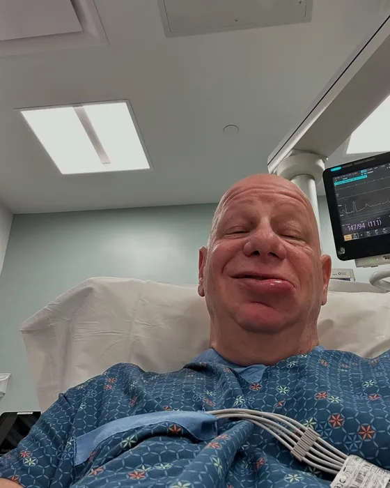 Bir dondurma yüzünden acillik oldu! Ünlü komedyen son halini paylaştı: Sosyal medyayı salladı! İşte o görüntü...