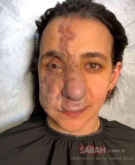 Öyle bir değişti ki....Son haline kendisi bile inanamadı!