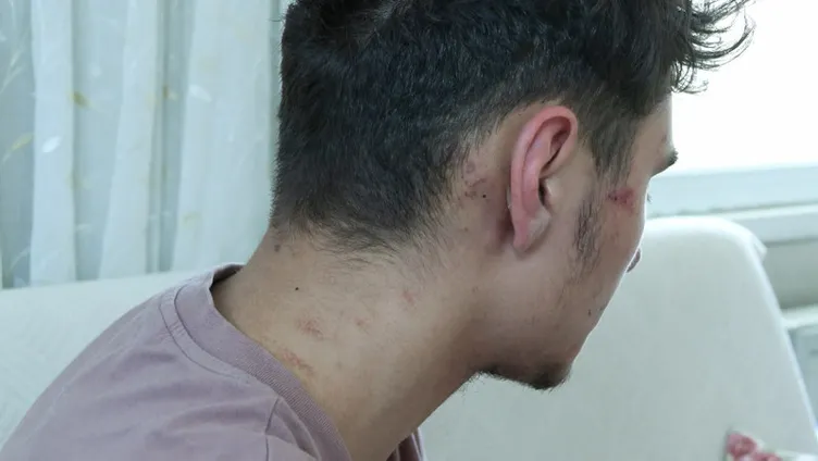 Akaryakıt istasyonunda bayıltan dayak! Dakikalarca dövülen gencin babası isyan etti: Vicdanınız yok mu...