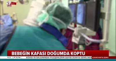 Ankara’daki doğumda korkunç son! Bebeğin kafası doğumda koptu | Video