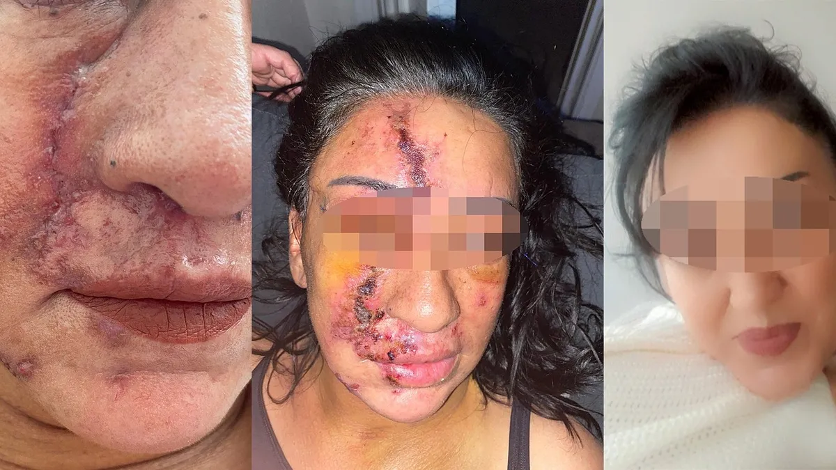 Yine estetik faciası