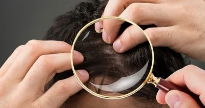 Saç dökülmesini durduruyor!