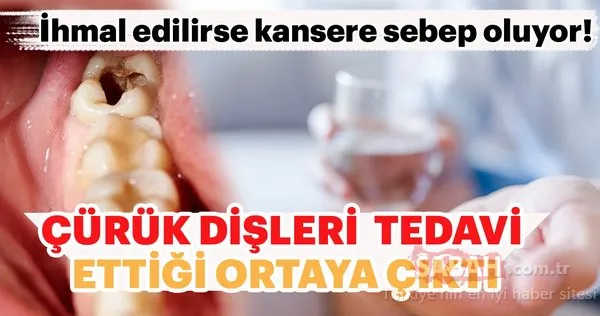 Curuk Disleri Ve Lekeleri Aninda Tedavi Ediyor Son Dakika Haberler