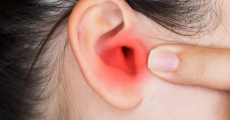 Orta kulak iltihabı iyileşme belirtileri nelerdir? Orta kulak iltihabı kaç günde geçer, iltihap ağrısına ne iyi gelir?