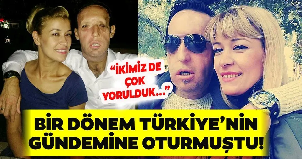 son dakika haberi yuz nakli olan recep sert ten kotu haber esi esma sert ile son dakika haberler