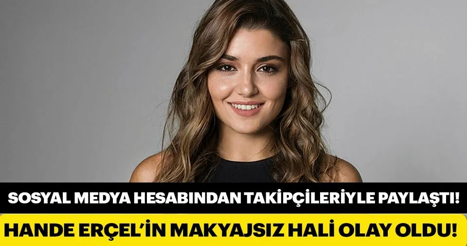 Hande Ercel In Makyajsiz Hali Olay Oldu Sayfa 7 Magazin Haberleri