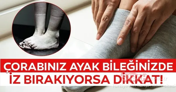Bu uyarılara dikkat! Kalbin düzgün çalışmadığını gösteren sekiz önemli işaret
