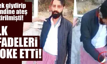 Etek giydirip kendini vurdurttular!