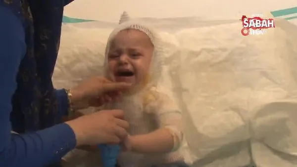 Üzerine kaynar süt dökülen 1 yaşındaki çocuk feci şekilde yandı | Video