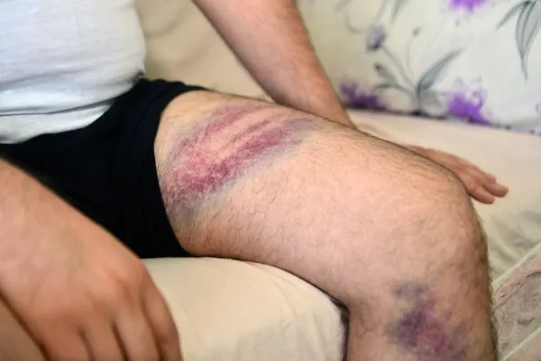 Noter önündeki tartışma