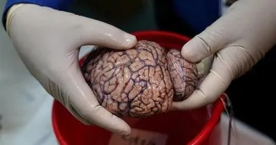 İşte karşınızda beyin bankası!