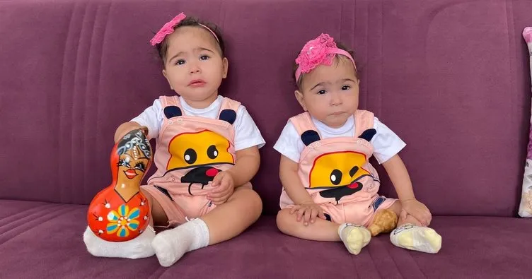 Tek yumurta ikizleri Akdeniz Üniversitesi Hastanesi’nde sağlığına kavuştu